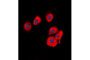 Immunofluorescent analysis of OLFML2B staining in HuvEc cells.