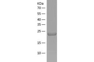 Western Blotting (WB) image for Nuclear Receptor Interacting Protein 3 (NRIP3) (AA 1-241) protein (His-IF2DI Tag) (ABIN7124212)