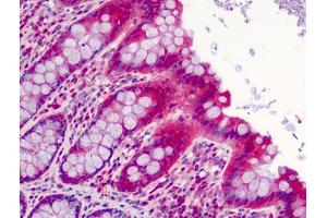 Human Colon: Formalin-Fixed, Paraffin-Embedded (FFPE) (SLFN12 anticorps  (C-Term))