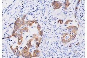 Immunohistochemistry (IHC) image for anti-Fas (TNFRSF6)-Associated Via Death Domain (FADD) (AA 1-208), (N-Term) antibody (ABIN317514) (FADD anticorps  (N-Term))