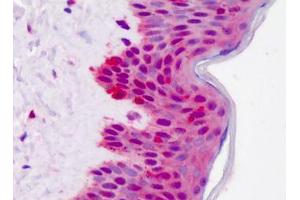 Human Skin: Formalin-Fixed, Paraffin-Embedded (FFPE)