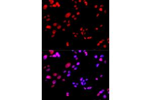 Immunofluorescence analysis of GFP-RNF168 transgenic U2OS cells using RPA2 antibody (ABIN5971215). (RPA2 anticorps)
