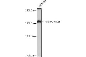 Western blot analysis of extracts of Rat brain, using PIK3R4/VPS15 Rabbit mAb (ABIN7269322) at 1:1000 dilution.