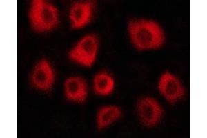 ABIN6267417 staining HepG2 cells by ICC/IF. (Vinculin anticorps  (pTyr822))