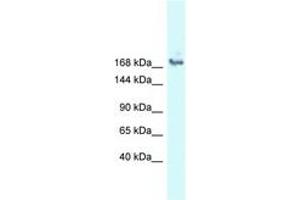 Image no. 1 for anti-Small Nuclear Ribonucleoprotein 200kDa (U5) (SNRNP200) (AA 212-261) antibody (ABIN6747810) (SNRNP200 anticorps  (AA 212-261))