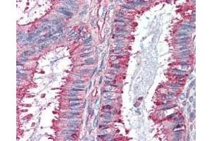 Immunohistochemistry (IHC) image for anti-G Protein-Coupled Receptor 27 (GPR27) (2nd Extracellular Domain) antibody (ABIN2470773)