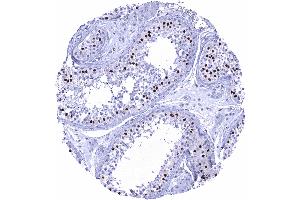 Testis Strong SOX9 staining of Sertoli cells