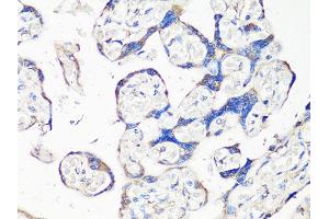 Immunohistochemistry of paraffin-embedded human placenta using MMP2 Antibody (ABIN4904395) at dilution of 1:100 (40x lens). (MMP2 anticorps)