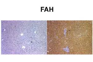 Sample Type: Human Liver and Mouse FAH KO liverPrimary Dilution: 1:400 (FAH anticorps  (C-Term))