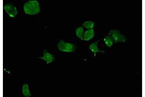 Immunofluorescent analysis of MCF-7 cells using ABIN7161170 at dilution of 1:100 and Alexa Fluor 488-congugated AffiniPure Goat Anti-Rabbit IgG(H+L) (SYNE2 anticorps  (AA 1-176))
