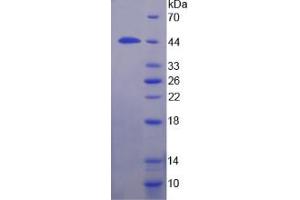 SDS-PAGE analysis of Human TBP Protein. (TBP Protéine)