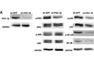 Peroxisome proliferator-activated receptor-gamma coactivator-1 β (PGC-1β) knockdown attenuates proinflammatory cytokines, matrix metalloproteinases (MMPs) and receptor activator of nuclear factor-kappa B ligand (RANKL) production in rheumatoid arthritis (RA)-fibrolast-like synoviocytes (FLS). (PPARGC1B anticorps  (AA 901-1023))