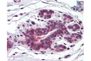 Anti-ELOVL5 antibody IHC of human breast. (ELOVL5 anticorps  (Internal Region))