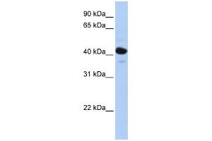 HSD11B2 antibody used at 1 ug/ml to detect target protein.