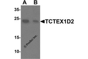 Western Blotting (WB) image for anti-Tctex1 Domain Containing 2 (TCTEX1D2) (N-Term) antibody (ABIN1587948) (TCTEX1D2 anticorps  (N-Term))