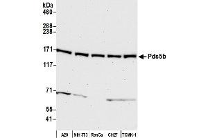 Western Blotting (WB) image for anti-PDS5, Regulator of Cohesion Maintenance, Homolog B (PDS5B) (AA 1200-1250) antibody (ABIN7455224)