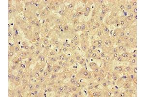 Immunohistochemistry of paraffin-embedded human liver tissue using ABIN7158760 at dilution of 1:100 (LPCAT3 anticorps  (AA 306-363))
