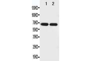 Anti-Netrin 1 antibody, Western blotting Lane 1: U87 Cell Lysate Lane 2: COLO320 Cell Lysate (Netrin 1 anticorps  (N-Term))