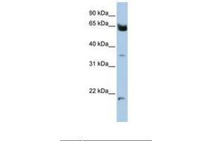 Image no. 1 for anti-Homeobox and Leucine Zipper Encoding (HOMEZ) (AA 72-121) antibody (ABIN6738394)