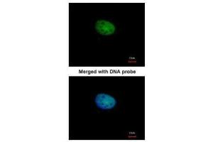ICC/IF Image Immunofluorescence analysis of paraformaldehyde-fixed HeLa, using RBP-Jkappa, antibody at 1:100 dilution.