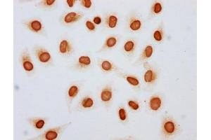 Immunocytochemistry analysis of ABIN7139198 diluted at 1:10 and staining in Hela cells (treated with 30mM sodium butyrate for 4h) performed on a Leica BondTM system.