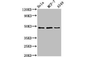 Western Blot Positive WB detected in: Hela whole cell lysate, MCF-7 whole cell lysate, A549 whole cell lysate All lanes: LCOR antibody at 4.