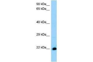 WB Suggested Anti-4930572J05Rik Antibody Titration: 1.