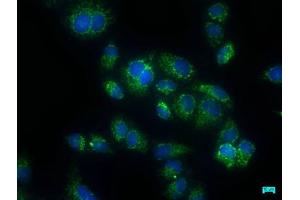 Immunofluorescence staining of Hela cells with ABIN7146911 at 1:50, counter-stained with DAPI. (CARD16 anticorps  (AA 1-197))