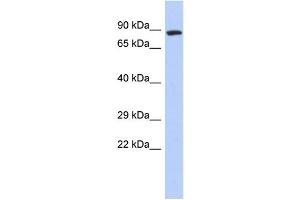 WB Suggested Anti-ZFYVE20 Antibody Titration:  0. (Rabenosyn 5 anticorps  (N-Term))
