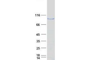 Validation with Western Blot