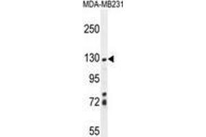 ZSWIM6 Antibody (C-term) western blot analysis in MDA-MB231 cell line lysates (35 µg/lane). (ZSWIM6 anticorps  (C-Term))