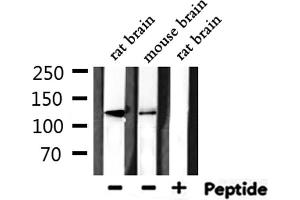 Western blot analysis of extracts from rat brain, mouse brain, using HDAC5 Antibody.