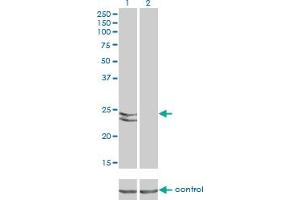 Western blot analysis of RAB27A over-expressed 293 cell line, cotransfected with RAB27A Validated Chimera RNAi (Lane 2) or non-transfected control (Lane 1).