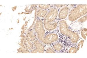 Detection of SHBG in Human Kidney Tissue using Monoclonal Antibody to Sex Hormone Binding Globulin (SHBG)