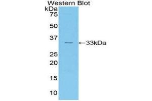 Western Blotting (WB) image for anti-RAR-Related Orphan Receptor C (RORC) (AA 212-461) antibody (ABIN1860466)