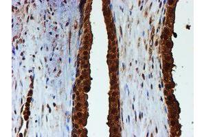 Image no. 15 for anti-Proteasome (Prosome, Macropain) Subunit, beta Type, 9 (Large Multifunctional Peptidase 2) (PSMB9) (AA 21-219) antibody (ABIN1491194)