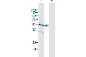 Western Blot analysis of TNFRSF19 expression in transfected 293T cell line by TNFRSF19 MaxPab polyclonal antibody.