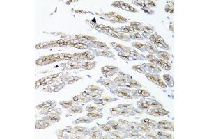 Immunohistochemistry of paraffin-embedded mouse stomach using IER3 antibody (ABIN6134174, ABIN6142158, ABIN6142159 and ABIN6224665) at dilution of 1:100 (40x lens).
