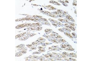 Immunohistochemistry of paraffin-embedded mouse stomach using IER3 antibody (ABIN6134174, ABIN6142158, ABIN6142159 and ABIN6224665) at dilution of 1:100 (40x lens). (IER3 anticorps  (C-Term))