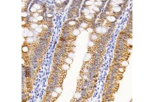Immunohistochemistry of paraffin embedded rat small intestine using ATP1A1 (ABIN7073154) at dilution of 1: 500 (400x lens) (ATPase (Na/K) anticorps)