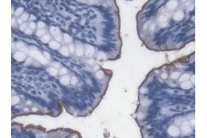 Detection of LPS in Rat Colon Tissue using Monoclonal Antibody to Lipopolysaccharide (LPS)