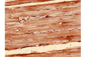 Immunocytochemistry analysis of human skeletal muscle tissue using ABIN7170882 at dilution of 1:100