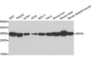 Western Blotting (WB) image for anti-Malate Dehydrogenase 2, NAD (Mitochondrial) (MDH2) antibody (ABIN1980313) (MDH2 anticorps)