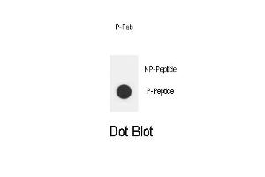Dot blot analysis of Phospho-ERBB2- Phospho-specific Pab (ABIN1881304 and ABIN2850444) on nitrocellulose membrane.