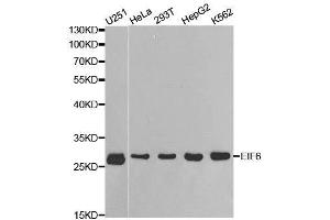 Western blot analysis of extracts of various cell lines, using EIF6 antibody. (EIF6 anticorps  (AA 1-245))