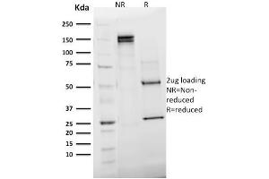 SDS-PAGE Analysis Purified Emerin Mouse Monoclonal Antibody (EMD/2168).