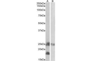 AP22426PU-N DCTN3 antibody staining of Mouse (A) and Rat (B) Skeletal Muscle lysates at 0. (DCTN3 anticorps  (Internal Region))