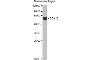 Western blot analysis of extracts of mouse esophagus, using COX10 Antibody (ABIN2561967) at 1:1000 dilution. (COX10 anticorps)