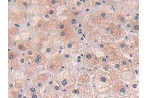 Detection of CPR in Human Liver Tissue using Polyclonal Antibody to Cytochrome P450 Reductase (CPR)