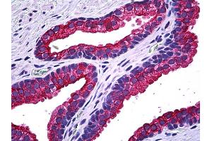 Anti-NPR2 antibody IHC of human prostate. (NPR2 anticorps  (AA 131-231))